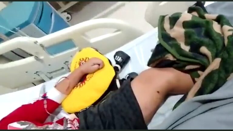 Niño pasó una semana con una bala en la pierna  