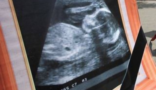 Corte Constitucional rechazó la despenalización del aborto por malformaciones