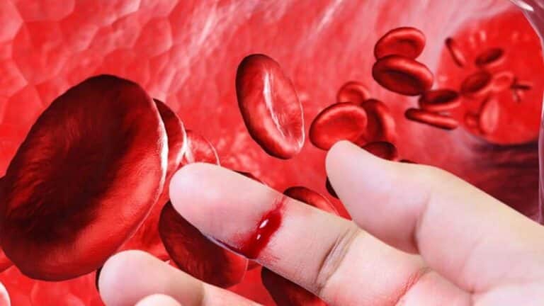 Pacientes con hemofilia: entre la esperanza y la preocupación